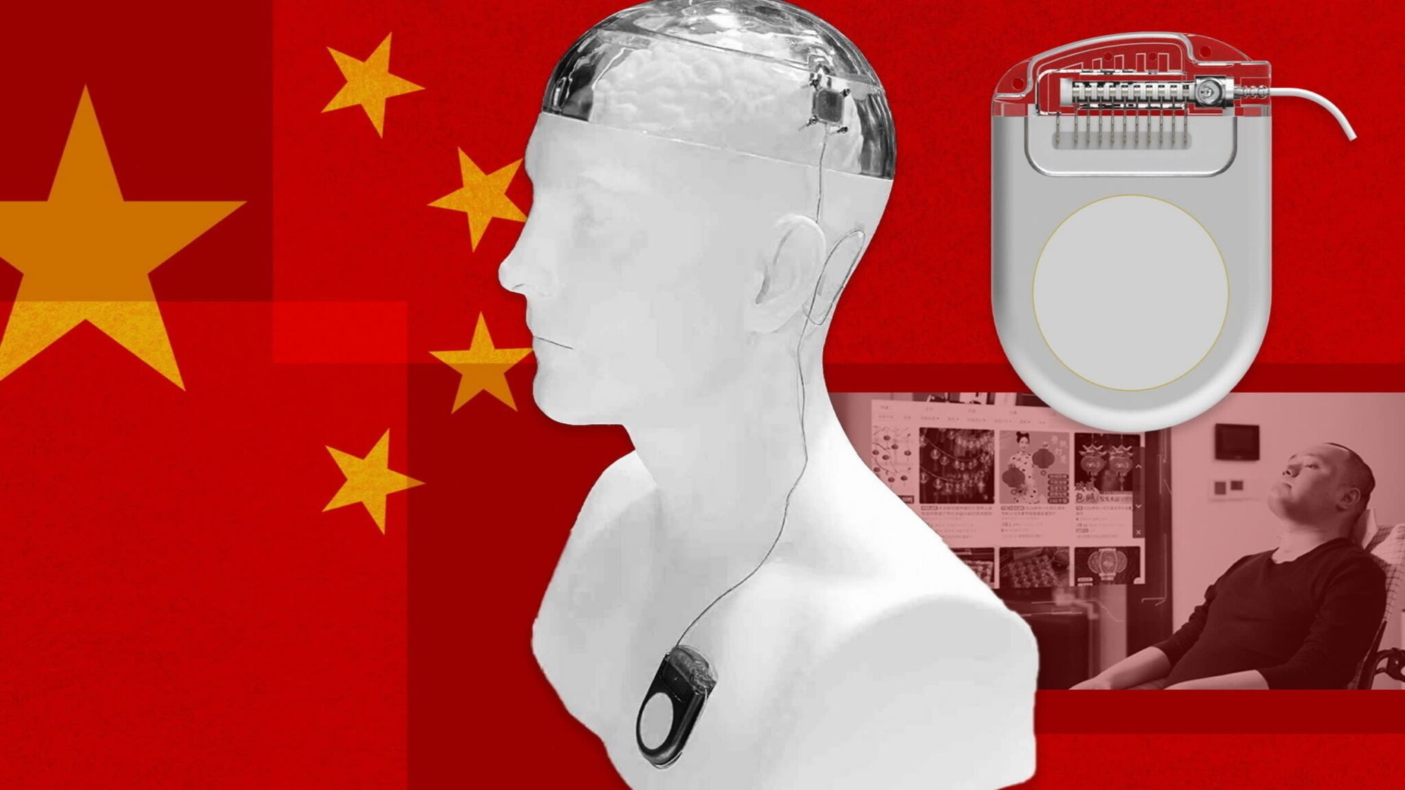 Beijing backs brain implant push to rival Elon Musk’s Neuralink  